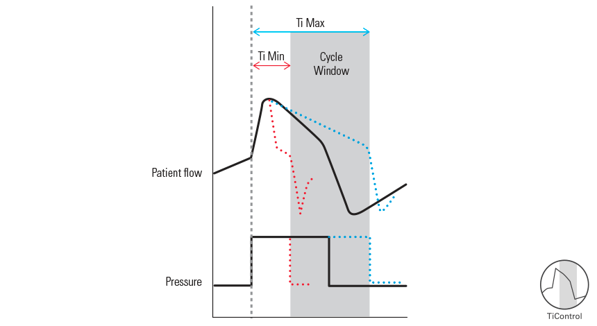 TiControl helps the patient to exhale