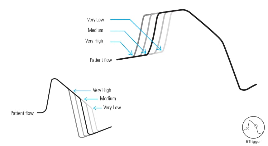 Five adjustable levels of trigger and cycle sensitivities