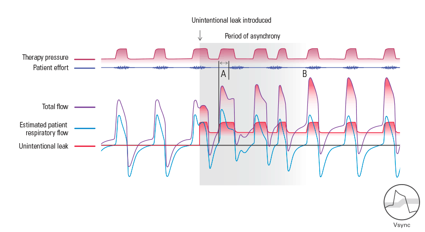 Vsync provides synchrony in the presence of leak