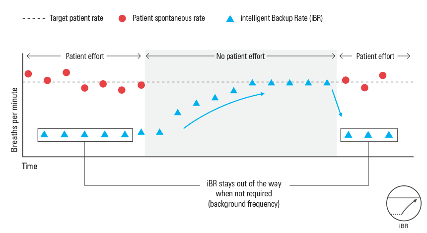 iBR inserts backup breaths only when needed