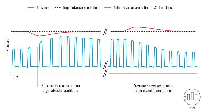 iVAPS delivers auto-adjusting pressure support