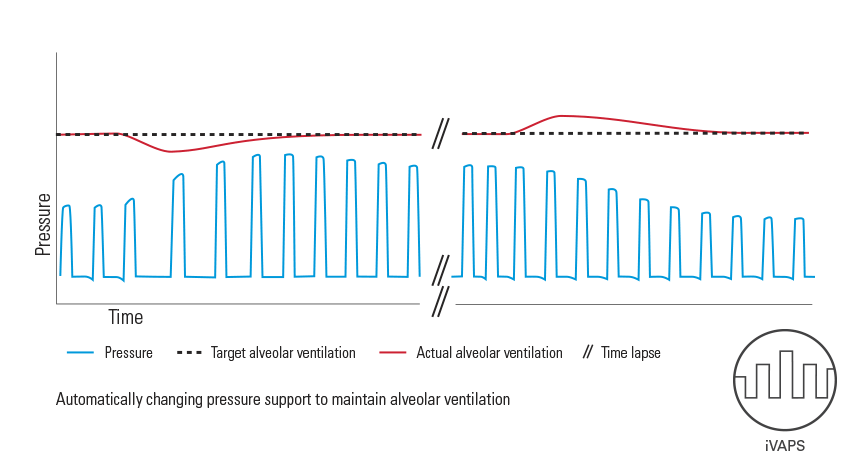 iVAPS (intelligent Volume-Assured Pressure Support) with an iBR (intelligent Back-up Rate)