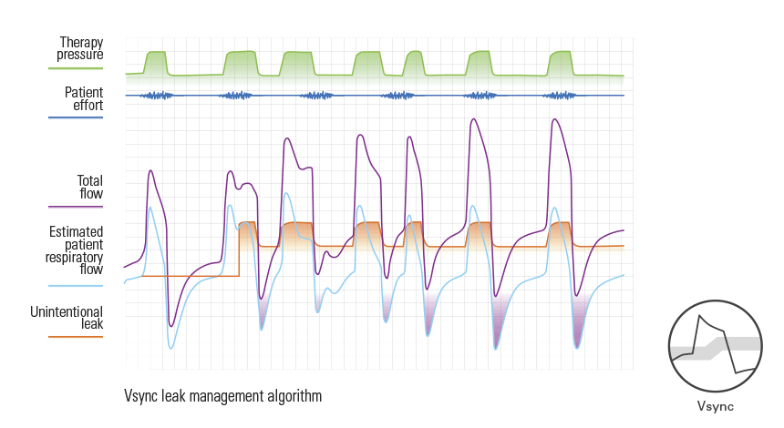 Vsync and TiControl